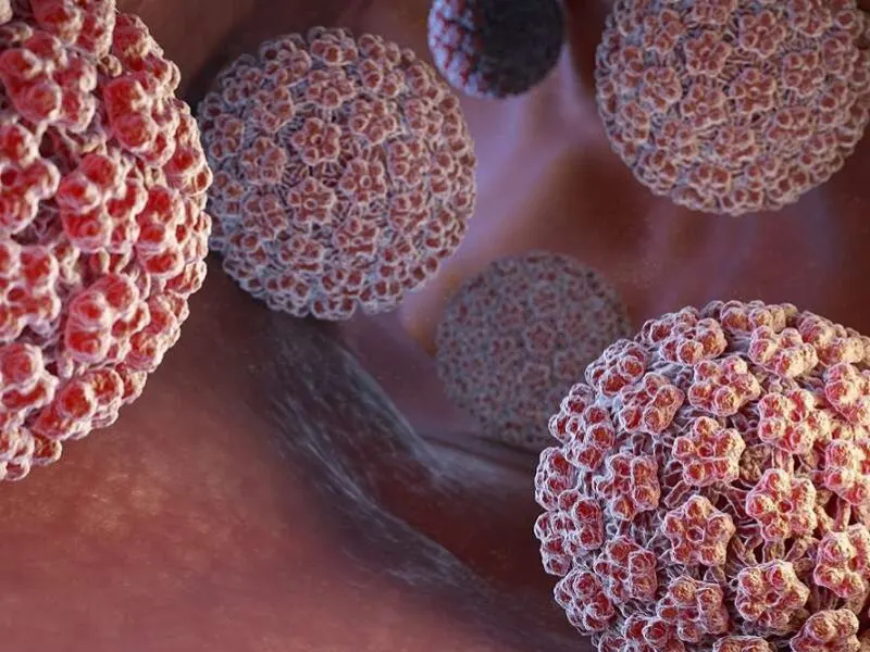 HPV