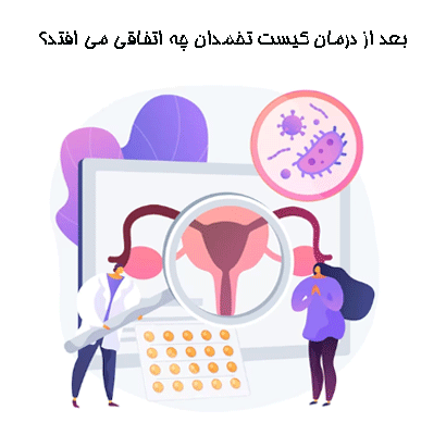 تخمدان